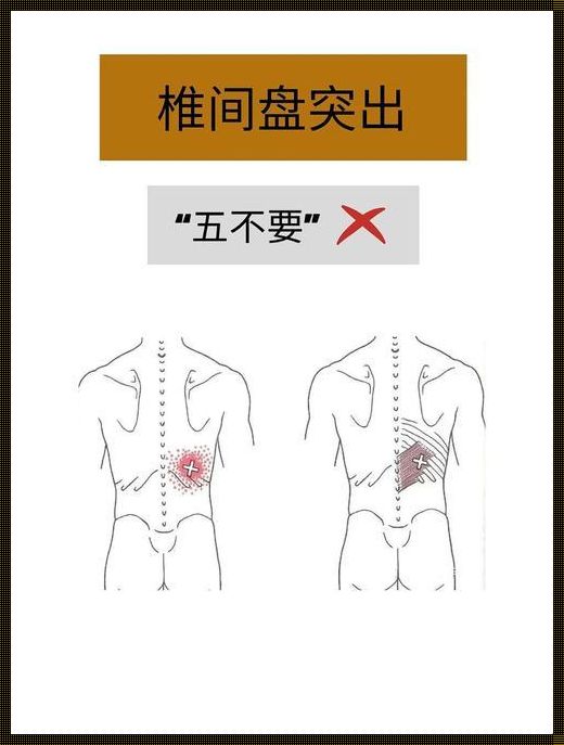 腰间盘最快恢复方法