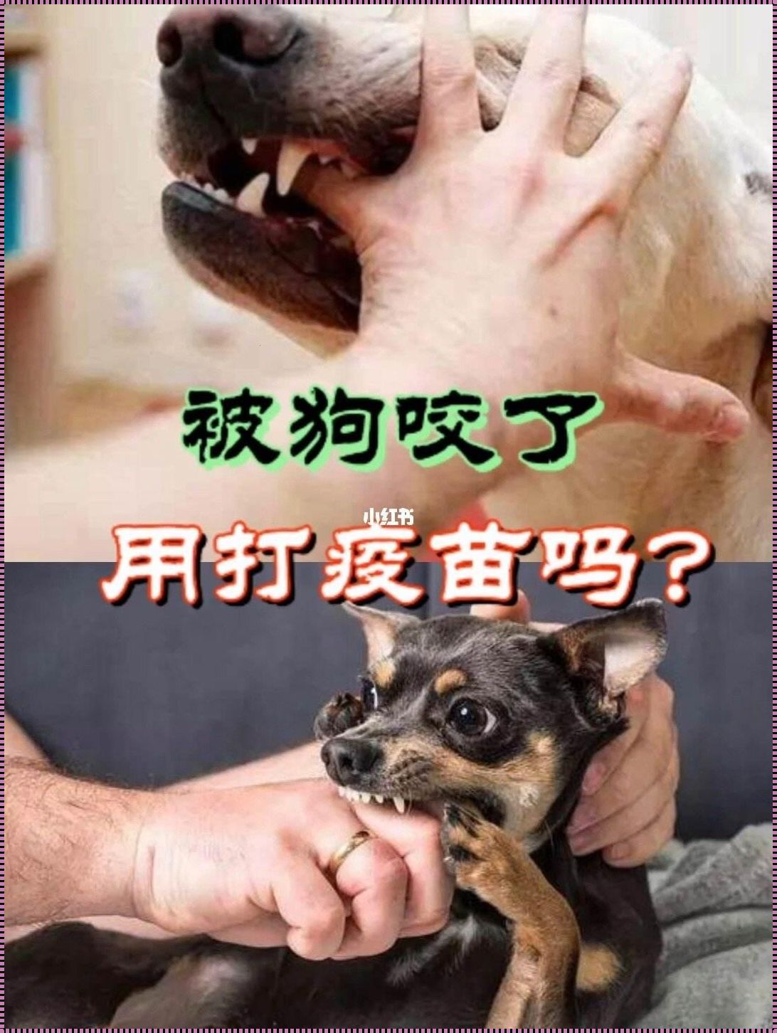 小孩儿不确定狗咬可以打针吗？揭秘