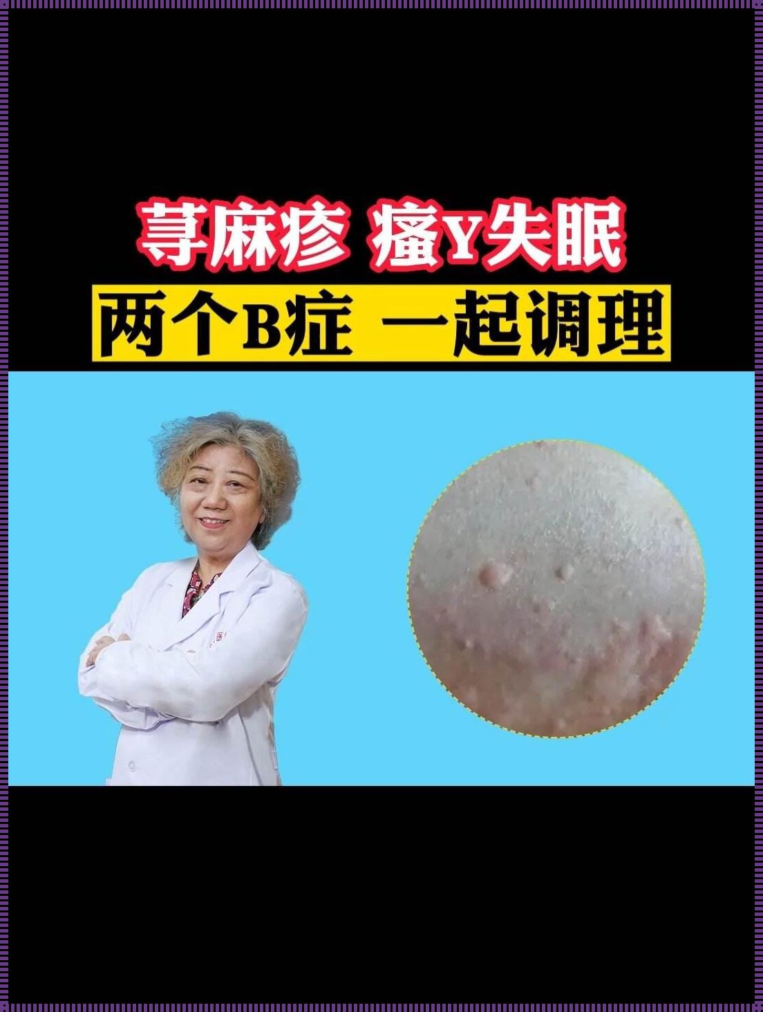 能和荨麻疹的人睡一起吗？