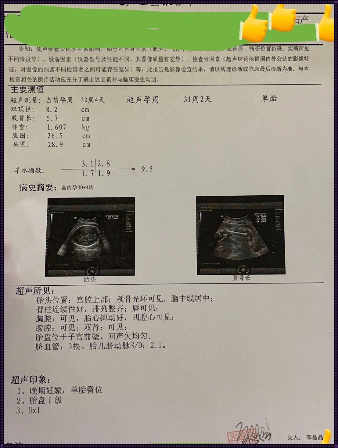 31周胎儿臀位还会变吗：探秘胎儿位置的演变