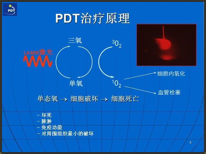 光动力做三次的原理：神秘面纱的揭露