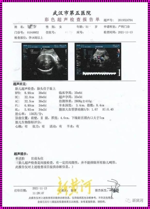 健康婴儿2个月突然死亡：一个无法解释的悲剧