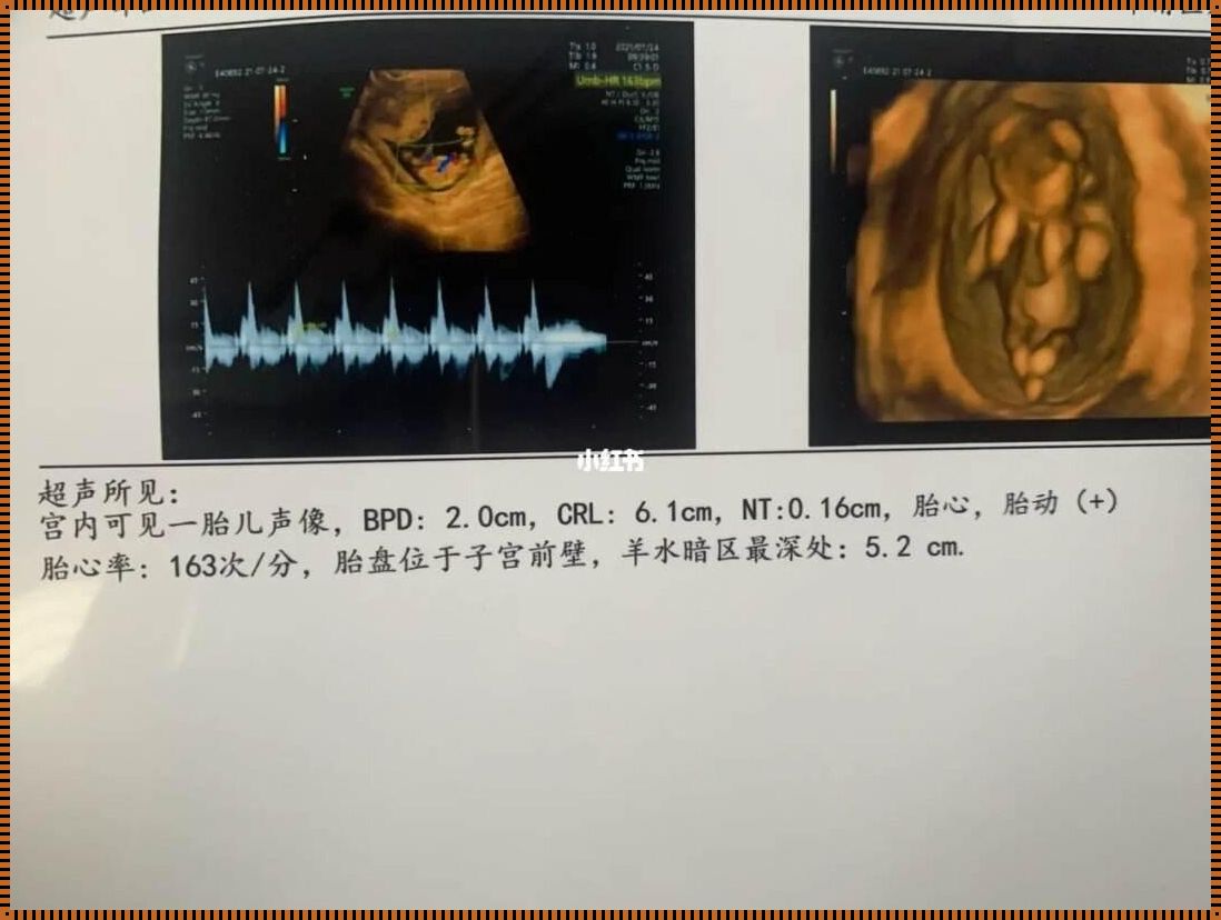 怀孕几周能看出男孩女孩视频：揭秘