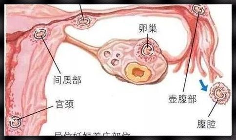 试管着床和自然怀孕着床有区别吗？