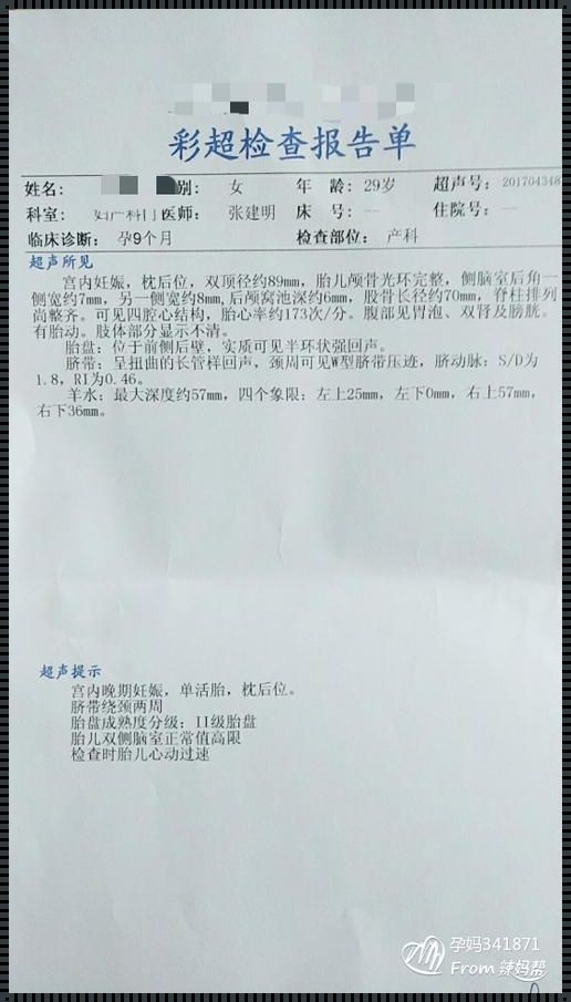 37周还是38周做产前大检查：充分准备迎接新生命的到来