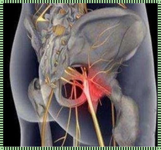 坐骨神经痛一辈子好不了吗