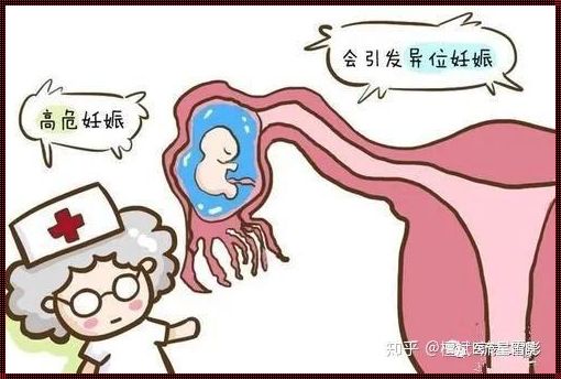 32周不想要了怎么才能流产