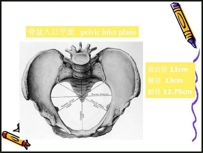 胎儿双肩径进入骨盆入口是在