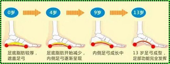 高弓足最佳治疗年龄：孩子成长的黄金时期