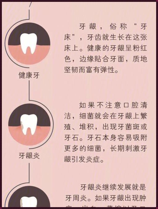 牙龈出血要警惕三种病