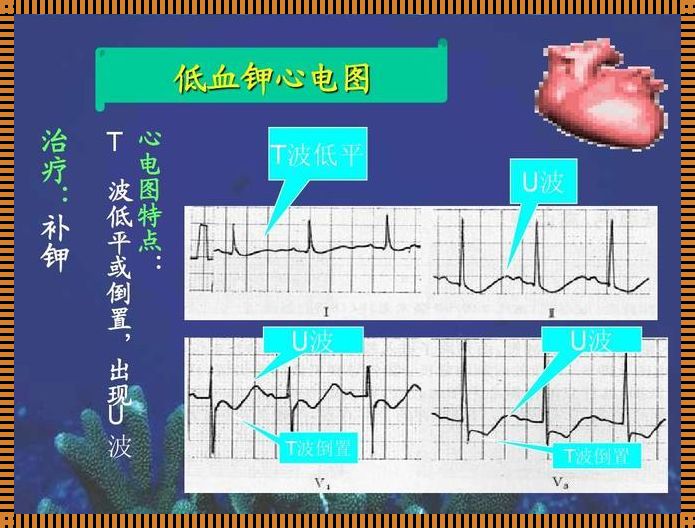 窦性心律心电轴右偏的原因