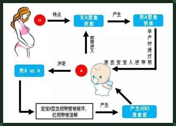 新生儿ABO溶血症状及表现——揭秘