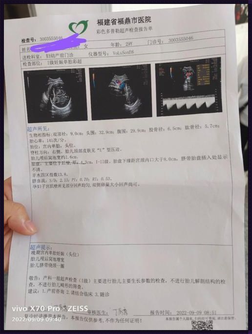 37周后颅窝池增宽14mm：揭开孕期神秘面纱的一角