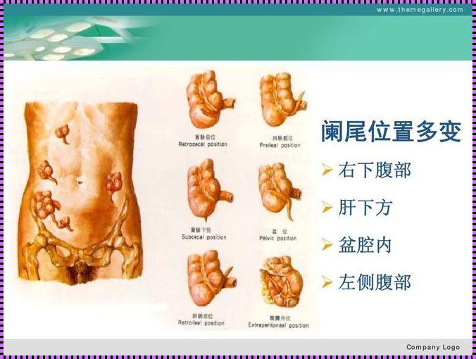 阑尾和附件的位置区别