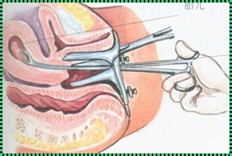 17周引产后清宫疼不疼：深入探究与心灵关怀