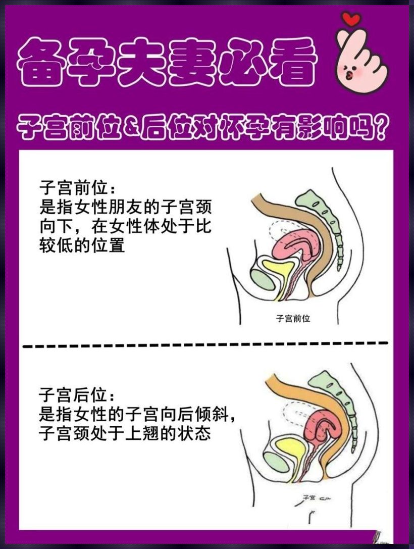 揭秘：子宫后位备孕小窍门