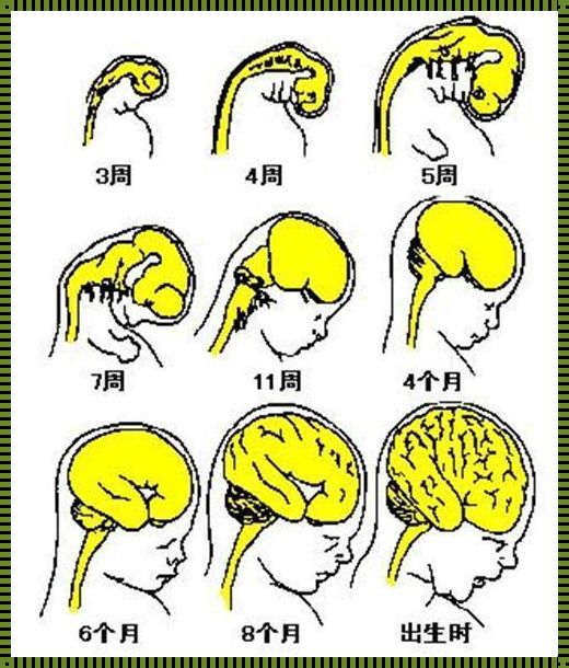 胎儿脑瘫是几个月形成的：生命的脆弱与坚强