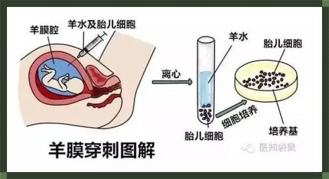 胎儿偏小一定要做羊水穿刺吗？