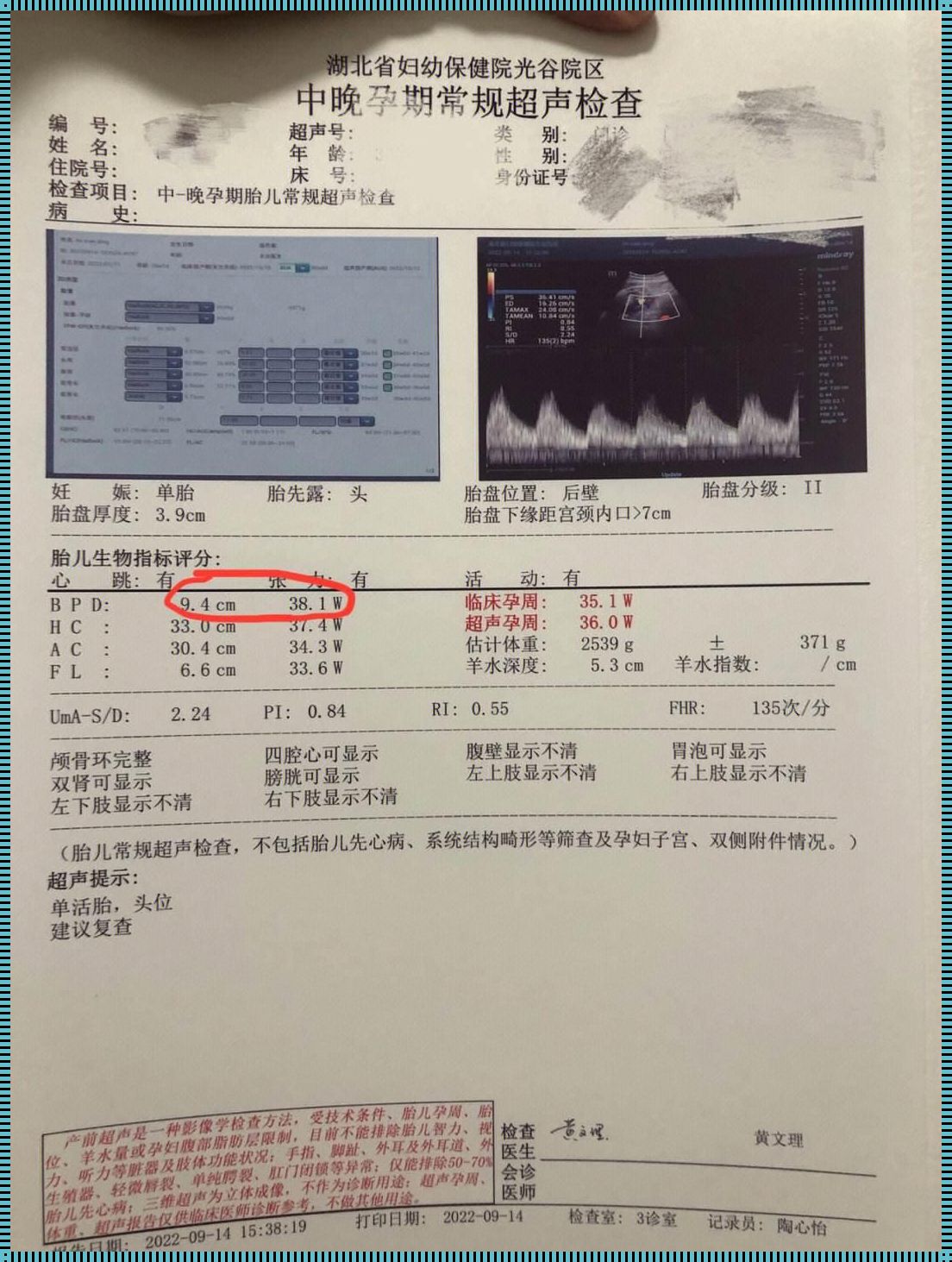 35周哭了对胎儿的影响