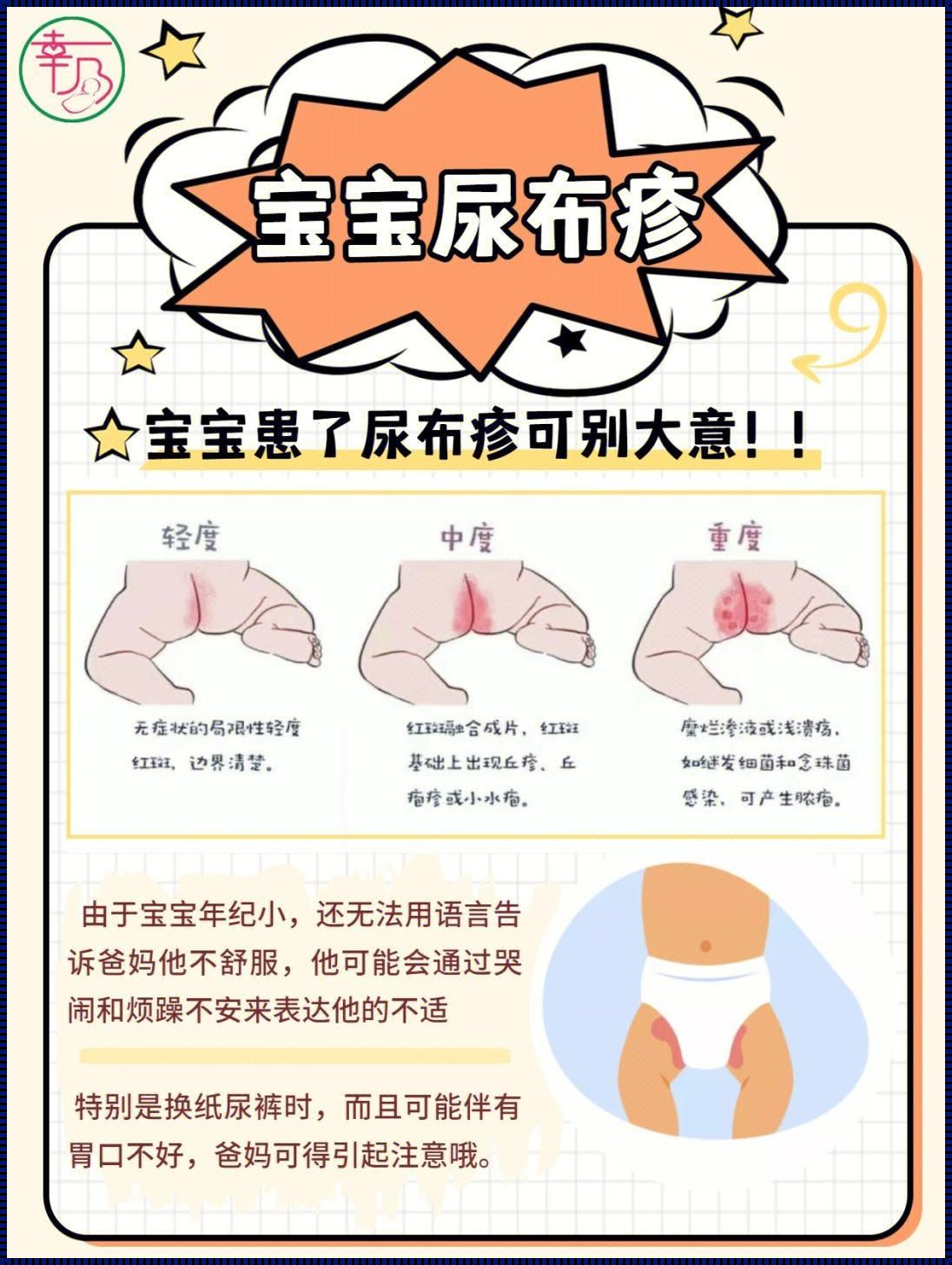 婴儿尿布疹快速消退方法：父母必知的护理秘籍