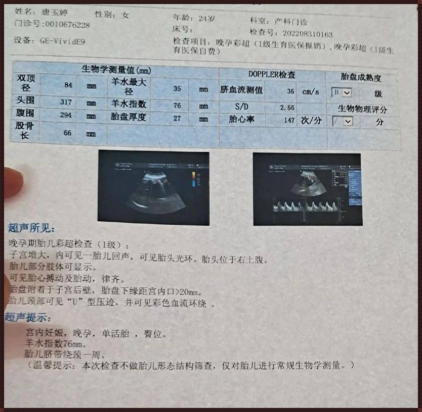 胎儿37周偏小两周算足月吗