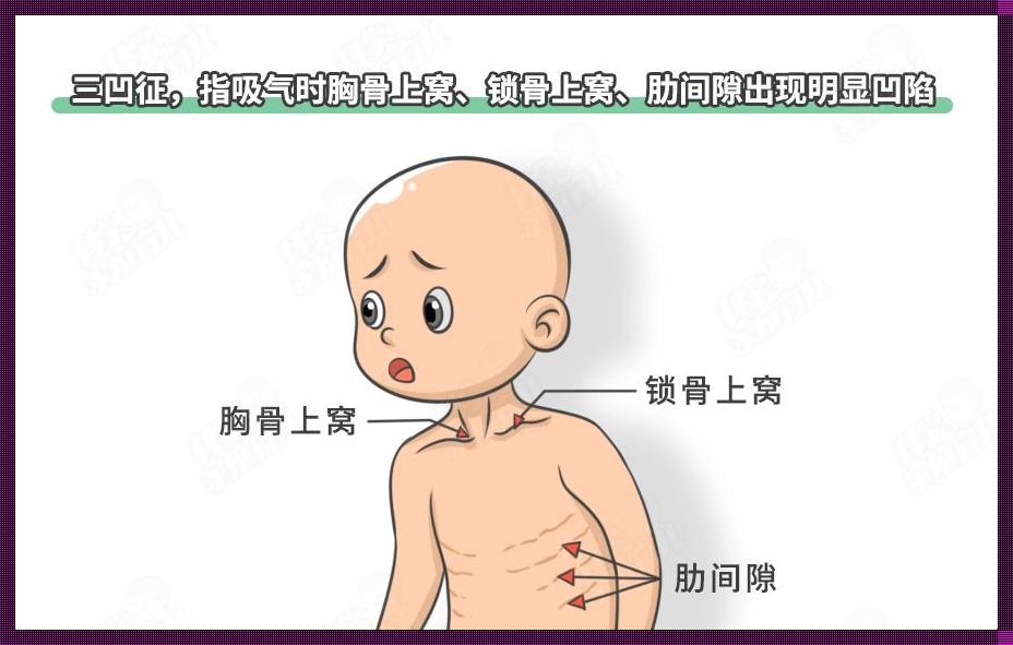 三凹征查体描述：医学探索中的细微观察