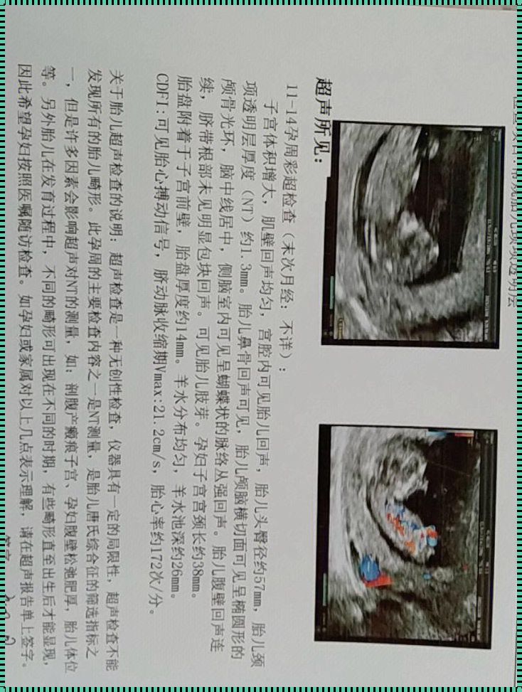 怀孕堕胎需要家长签字吗：深入探讨家庭、法律与个人选择的交织