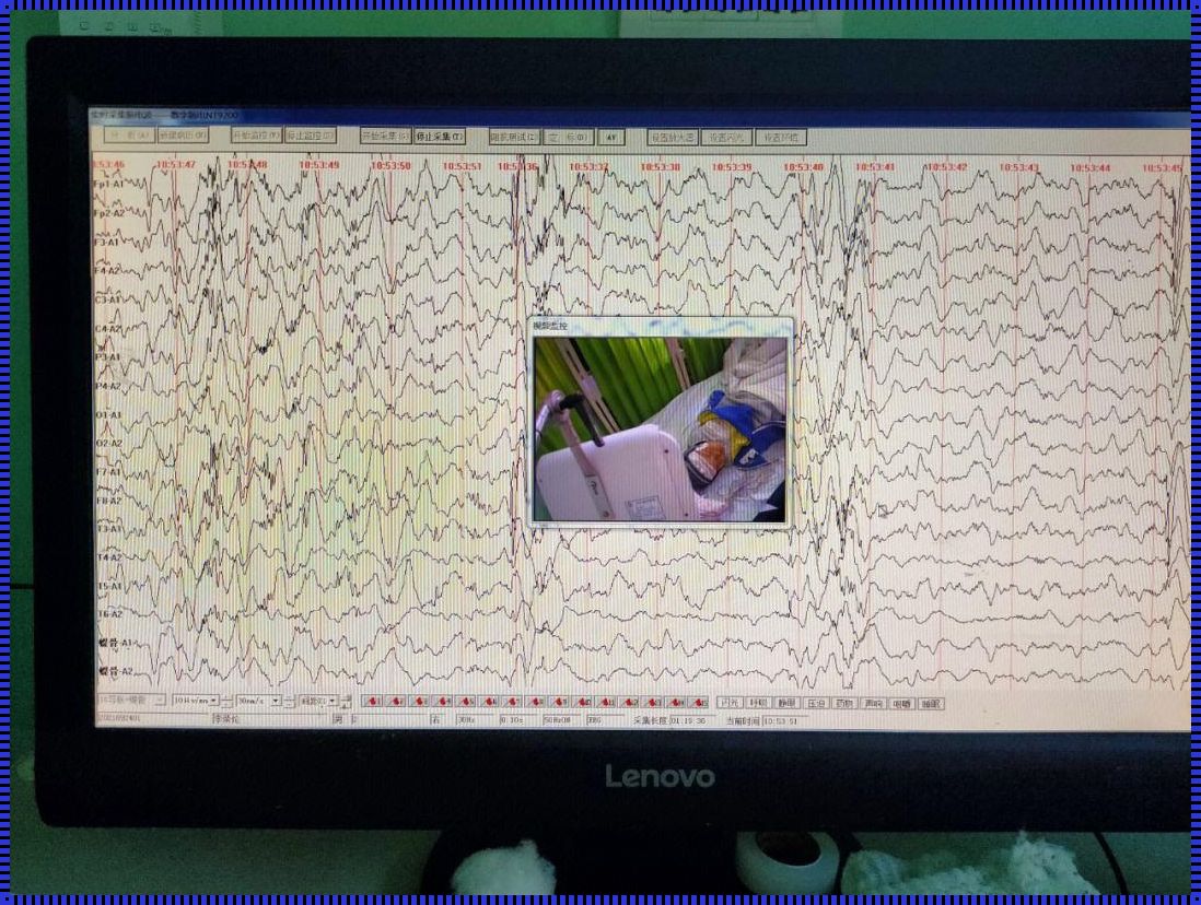 为什么小孩不建议做脑电图：深入剖析儿童脑部健康检查的考量