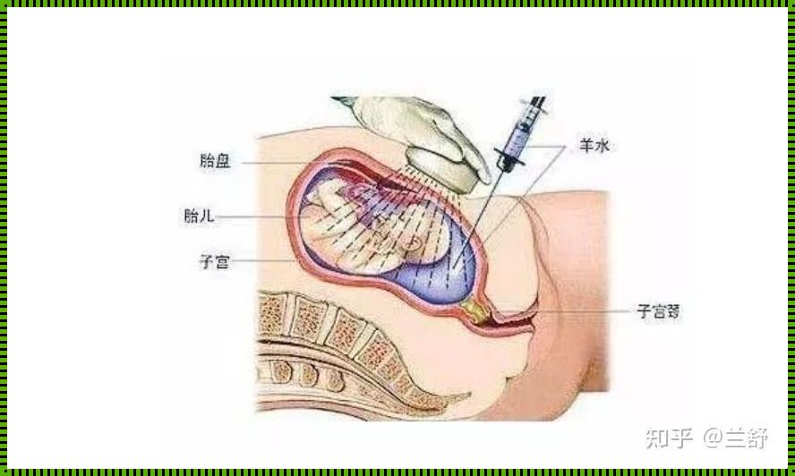 怀孕30周可以做引产吗：一个深入的探讨