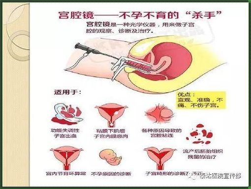 宫腔镜检查：探寻宫腔内的秘密