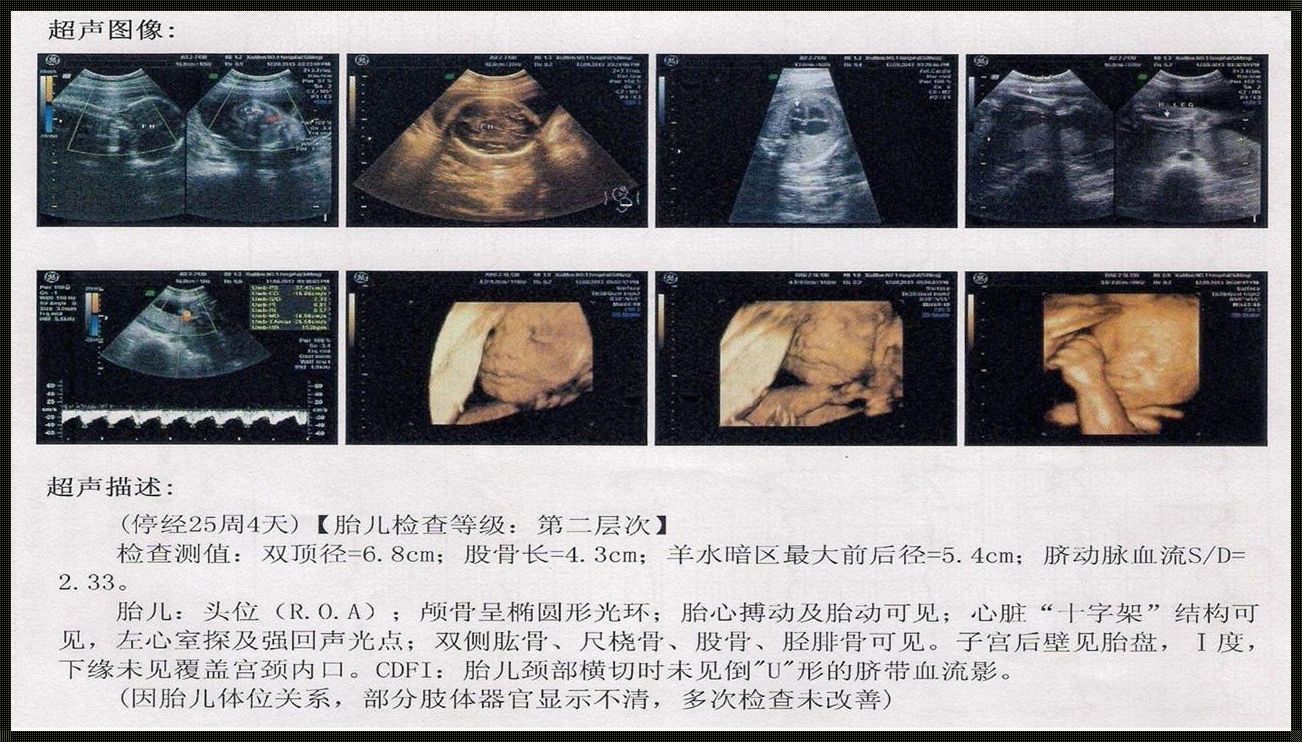 四维比超多少周做：探索与思考