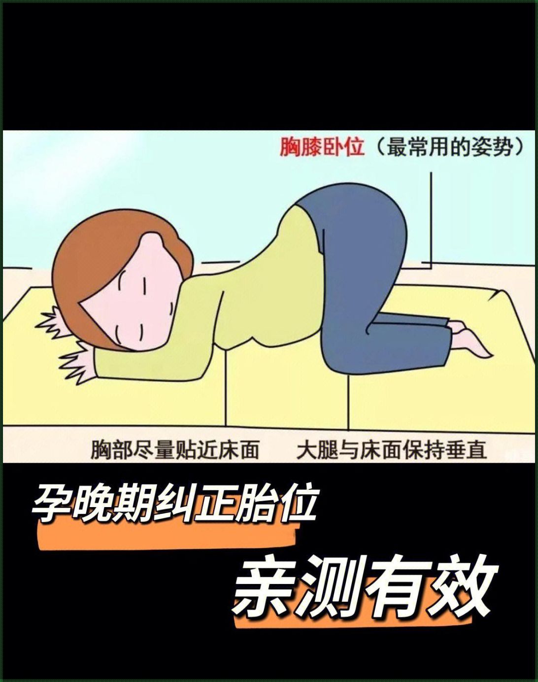 39周胎位rop怎么调整