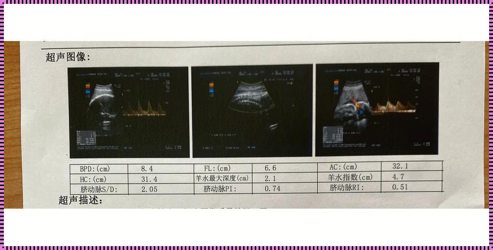 孕37周羊水指数58mm正常吗？一位母亲的内心独白