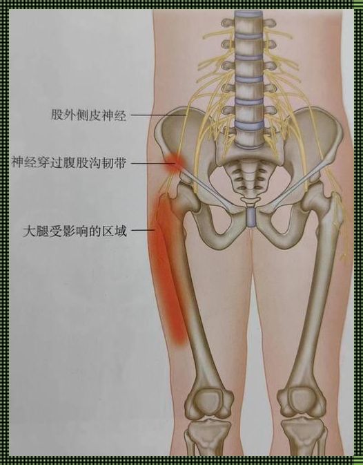 大腿外侧疼痛麻木：探寻身体之谜