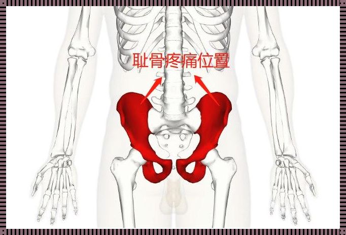 《髋部疼痛的奥秘：图解与思考》