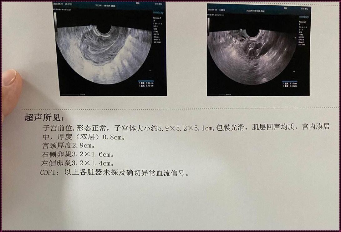 刮宫术后第二天重返工作岗位的思考