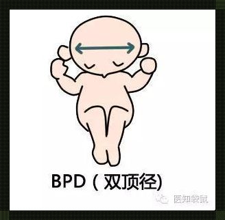 BPD：胎儿成长中不可忽视的里程碑