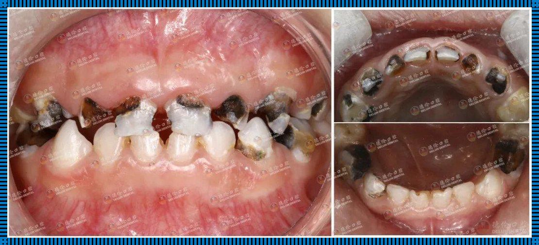 儿童口腔健康：守护纯真笑容的使命