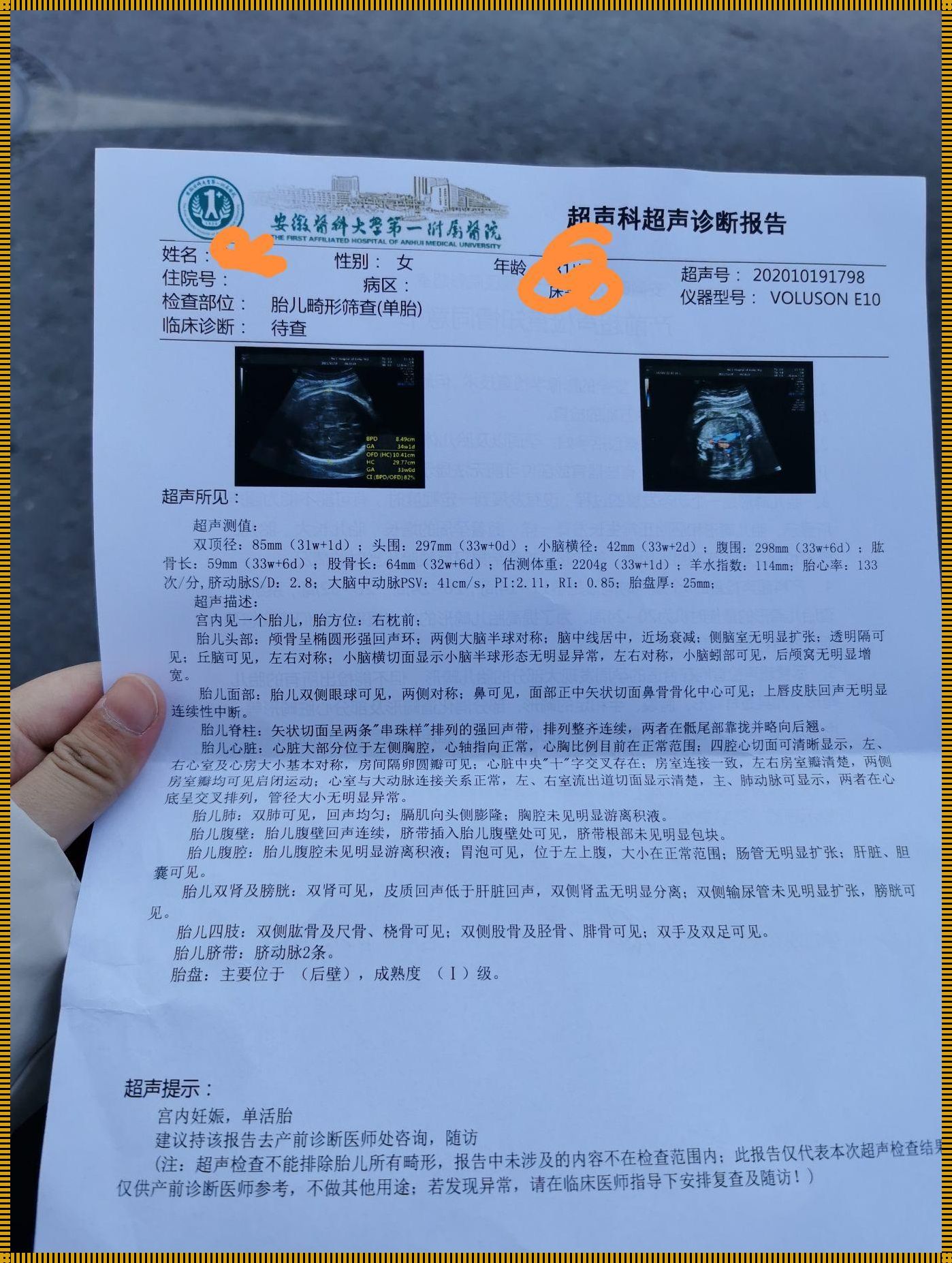 生命之光：31周小排畸报告的启示