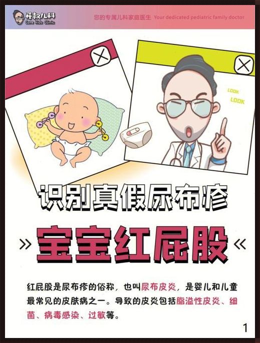 宝宝尿布疹红得厉害怎么办：温和护理与科学预防