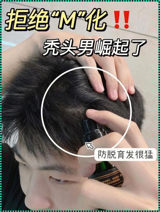 男生发缝变小的艺术与科学