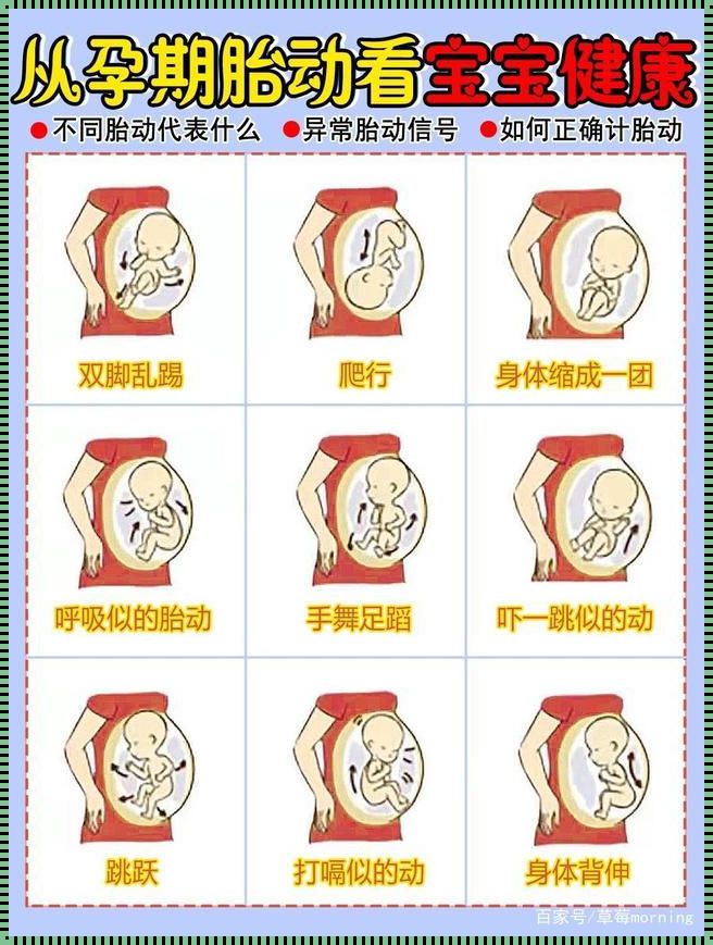 胎儿喜欢在右侧动是什么胎位