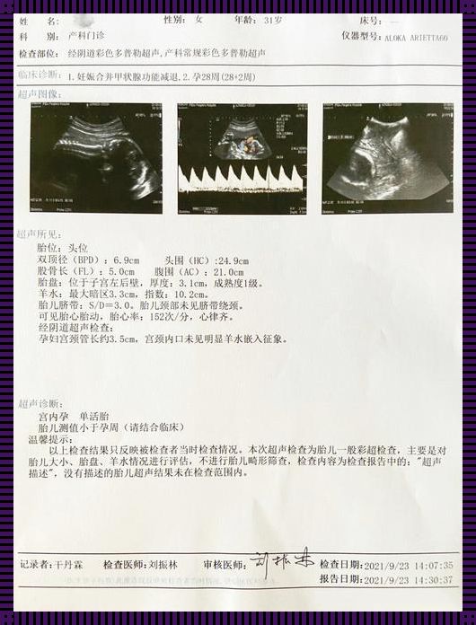 16周脐带绕颈2周的应对策略与心理支持