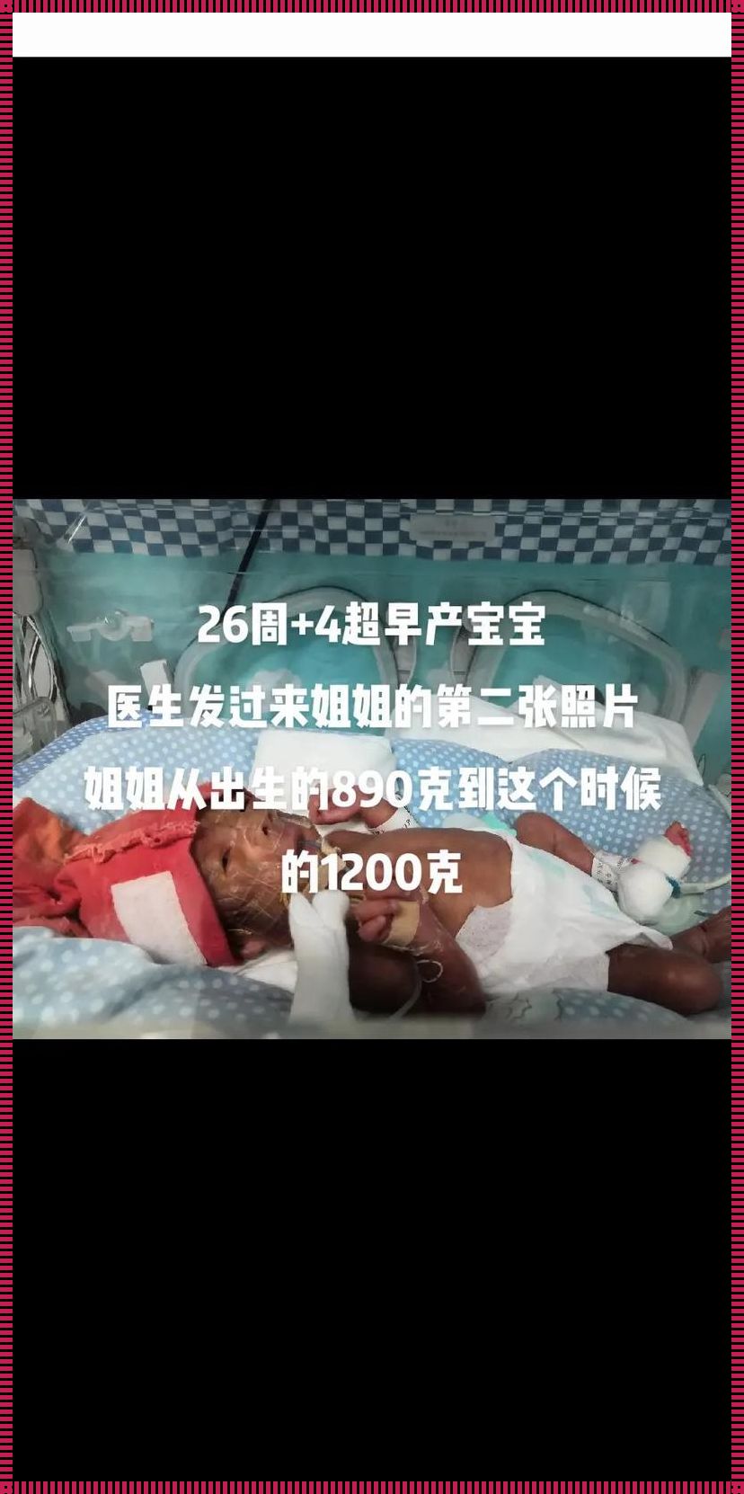 孕育希望：26周宝宝存活率的奇迹