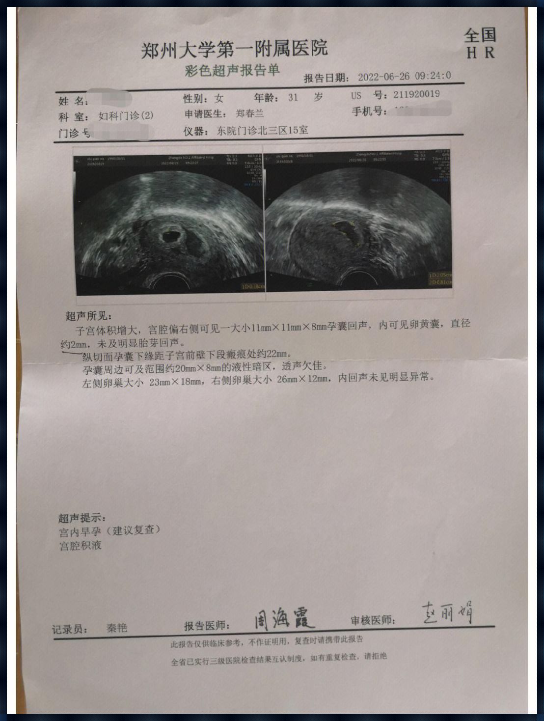 意外怀孕忘了末次月经：生命之花在不经意间绽放