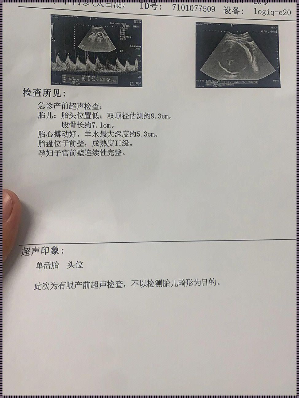 怀孕38周胎心120左右：生命的律动与期待