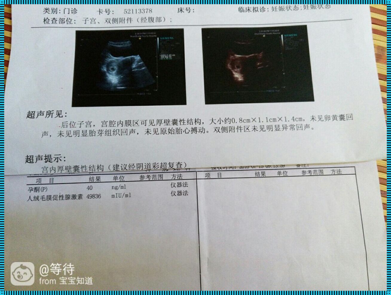 怀孕37天的抉择：安全与关怀并重