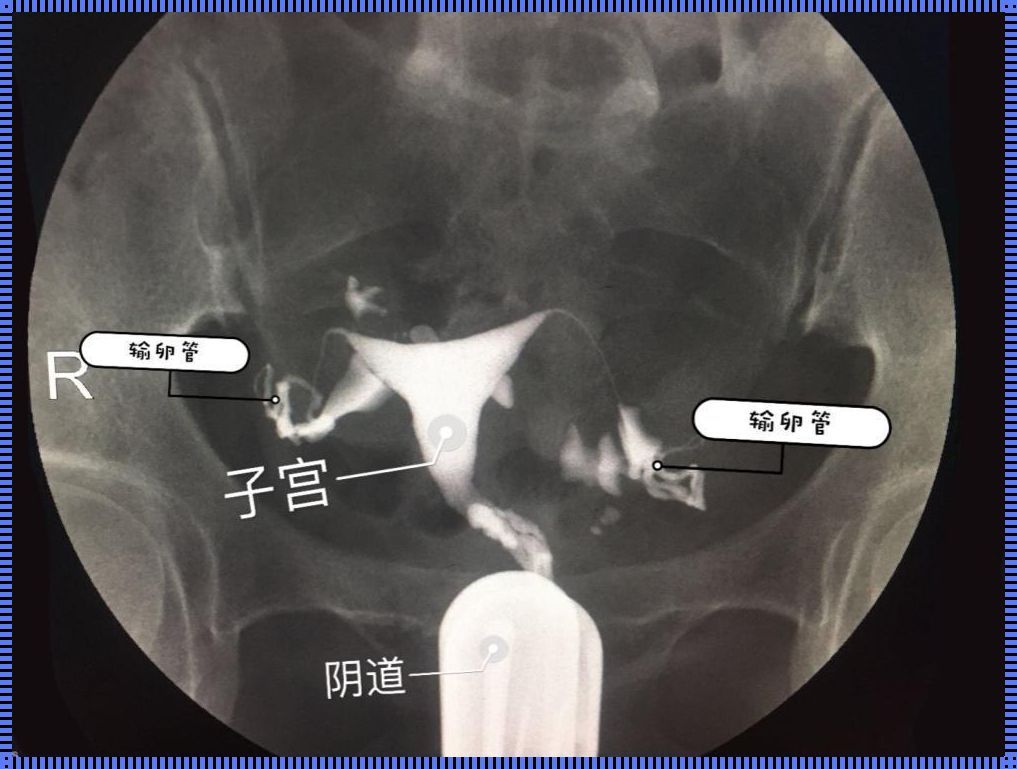 一直没怀孕需要做输卵管造影吗：生命的奇迹与科学探索