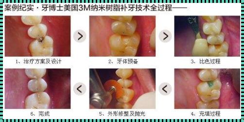 揭开育儿中“只有牙根”补牙的神秘面纱