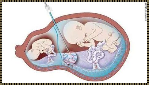 迈向双胞胎之路：揭秘增加怀孕双胞胎几率的奥秘